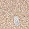 Lysosomal Protein Transmembrane 4 Beta antibody, FNab04695, FineTest, Immunohistochemistry paraffin image 