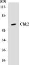 Checkpoint Kinase 2 antibody, EKC1113, Boster Biological Technology, Western Blot image 