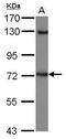 Leucine Rich Repeat And Ig Domain Containing 1 antibody, PA5-31282, Invitrogen Antibodies, Western Blot image 