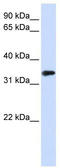 Methyl-CpG Binding Domain Protein 3 antibody, TA345664, Origene, Western Blot image 