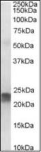 Transgelin antibody, orb88286, Biorbyt, Western Blot image 