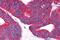 Prostaglandin D2 receptor antibody, NLS3279, Novus Biologicals, Immunohistochemistry paraffin image 