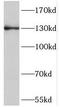 Nucleolar Protein 6 antibody, FNab05787, FineTest, Western Blot image 