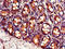 Y+L amino acid transporter 2 antibody, CSB-PA849761LA01HU, Cusabio, Immunohistochemistry paraffin image 