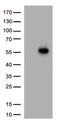 Interleukin-3 receptor subunit alpha antibody, TA813664, Origene, Western Blot image 