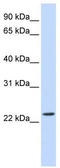 Putative SCAN domain-containing protein 2 antibody, TA344427, Origene, Western Blot image 