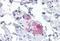 Stromal Interaction Molecule 1 antibody, MBS245849, MyBioSource, Immunohistochemistry paraffin image 