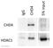 Chromodomain Helicase DNA Binding Protein 4 antibody, ab70469, Abcam, Immunoprecipitation image 
