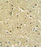 Paired Box 6 antibody, 62-543, ProSci, Immunohistochemistry paraffin image 