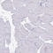 Histone deacetylase 8 antibody, HPA048560, Atlas Antibodies, Immunohistochemistry frozen image 