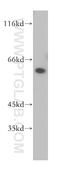 Docking Protein 1 antibody, 17822-1-AP, Proteintech Group, Western Blot image 