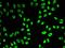 Small Nuclear Ribonucleoprotein Polypeptide A antibody, orb247419, Biorbyt, Immunocytochemistry image 