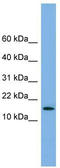 Sperm surface protein Sp17 antibody, TA335547, Origene, Western Blot image 
