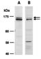 Fanconi anemia group I protein antibody, orb66893, Biorbyt, Western Blot image 