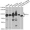 Acylaminoacyl-Peptide Hydrolase antibody, LS-C748517, Lifespan Biosciences, Western Blot image 