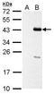 Proline/serine-rich coiled-coil protein 1 antibody, GTX128047, GeneTex, Western Blot image 