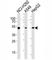 ALDH2 antibody, F40217-0.4ML, NSJ Bioreagents, Immunohistochemistry paraffin image 
