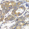 Phosphofructokinase, Muscle antibody, A5477, ABclonal Technology, Immunohistochemistry paraffin image 