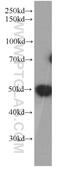 DEK Proto-Oncogene antibody, 66194-1-Ig, Proteintech Group, Western Blot image 