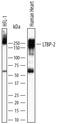 Latent-transforming growth factor beta-binding protein 2 antibody, AF3850, R&D Systems, Western Blot image 