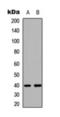 Serine/threonine-protein kinase LMTK3 antibody, orb393096, Biorbyt, Western Blot image 
