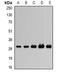 Ubiquinol-Cytochrome C Reductase, Rieske Iron-Sulfur Polypeptide 1 antibody, orb341180, Biorbyt, Western Blot image 