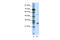 Leucine Rich Repeat Containing 14 antibody, 28-169, ProSci, Enzyme Linked Immunosorbent Assay image 