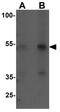 Kremen protein 2 antibody, GTX31529, GeneTex, Western Blot image 