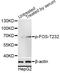 Fos Proto-Oncogene, AP-1 Transcription Factor Subunit antibody, AP0038, ABclonal Technology, Western Blot image 