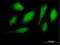 Ring Finger Protein 34 antibody, H00080196-B01P, Novus Biologicals, Immunocytochemistry image 