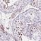 Kinetochore protein Spc24 antibody, NBP2-47264, Novus Biologicals, Immunohistochemistry frozen image 