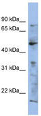 Rab3A-interacting protein antibody, TA337554, Origene, Western Blot image 