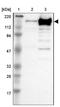 Erythrocyte Membrane Protein Band 4.1 Like 2 antibody, NBP1-90326, Novus Biologicals, Western Blot image 