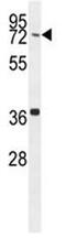 Coiled-coil domain-containing protein 38 antibody, GTX03392, GeneTex, Western Blot image 