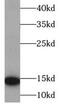 HBB antibody, FNab03768, FineTest, Western Blot image 