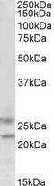 F-Box Protein 44 antibody, 45-581, ProSci, Western Blot image 