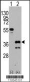 Zinc finger protein ZIC 4 antibody, 61-452, ProSci, Western Blot image 