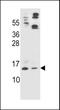 Apolipoprotein C2 antibody, 63-212, ProSci, Western Blot image 