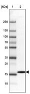 Derlin 2 antibody, NBP2-47485, Novus Biologicals, Western Blot image 
