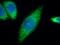 Mitochondrially Encoded ATP Synthase Membrane Subunit 6 antibody, 55313-1-AP, Proteintech Group, Immunofluorescence image 