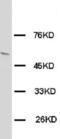 Solute Carrier Family 2 Member 4 antibody, orb18036, Biorbyt, Western Blot image 
