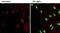 p38 antibody, MA5-15218, Invitrogen Antibodies, Immunofluorescence image 