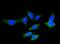 Fatty Acid Binding Protein 5 antibody, A02083, Boster Biological Technology, Immunofluorescence image 