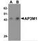 Adaptor Related Protein Complex 3 Subunit Mu 1 antibody, MBS150380, MyBioSource, Western Blot image 