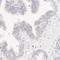 Spectrin Beta, Erythrocytic antibody, HPA003398, Atlas Antibodies, Immunohistochemistry paraffin image 