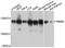 RNA-binding protein 5 antibody, STJ112684, St John