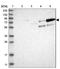 E3 ubiquitin-protein ligase AMFR antibody, NBP2-33917, Novus Biologicals, Western Blot image 