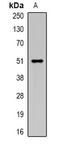 ATP Binding Cassette Subfamily C Member 1 antibody, orb377889, Biorbyt, Western Blot image 