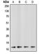 Caspase 3 antibody, LS-C351925, Lifespan Biosciences, Western Blot image 