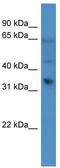 Olfactory Receptor Family 1 Subfamily D Member 2 antibody, TA342695, Origene, Western Blot image 